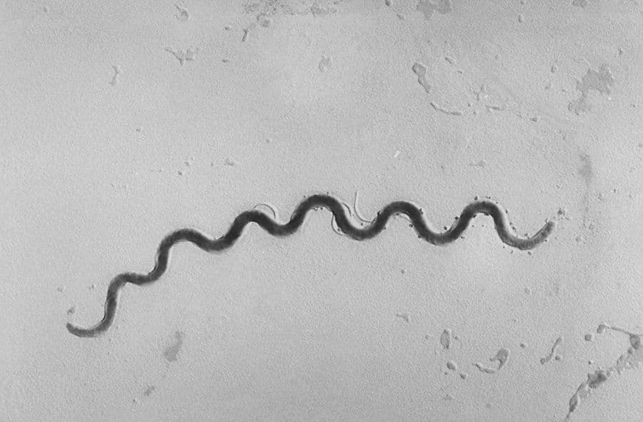 Syphilis making a comeback, health officials warn. CDC map shows where risk is highest